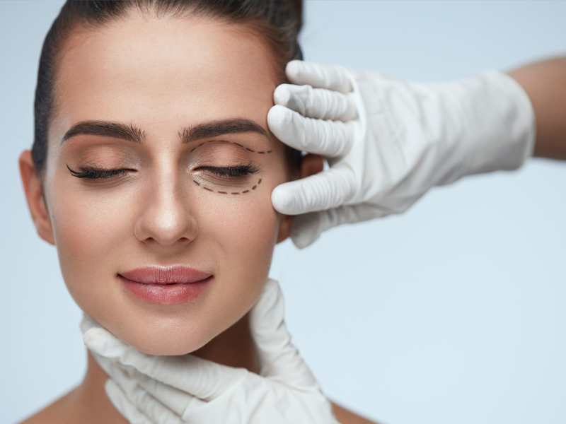 Cirugía de Párpados